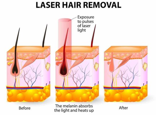 Retiro rápido portátil del pelo de la máquina multifuncional IPL del OPT IPL/del OPT